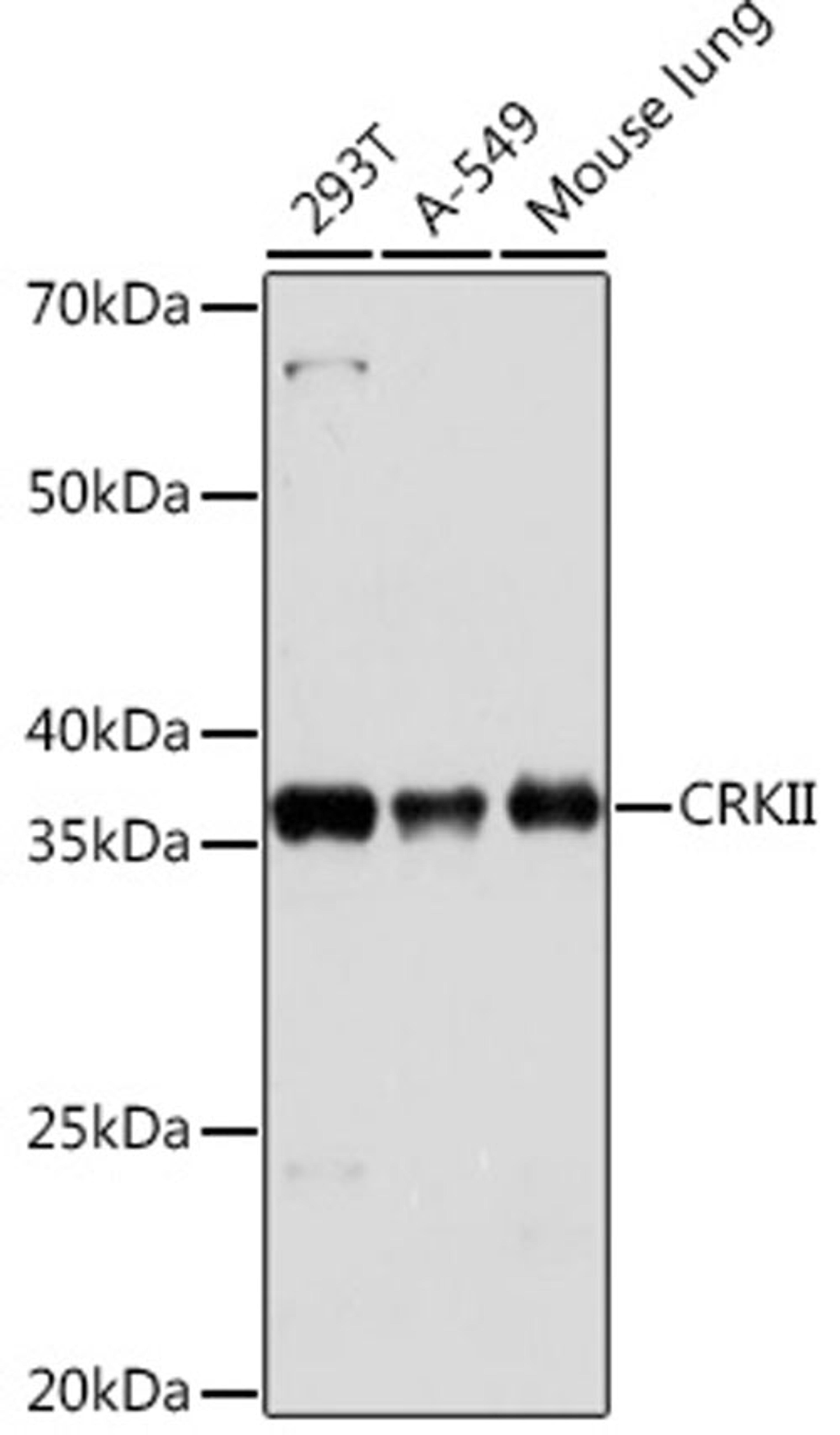 Western blot - CRKII Rabbit mAb (A9577)