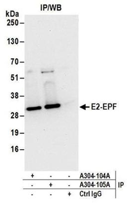 Detection of human E2-EPF by western blot of immunoprecipitates.