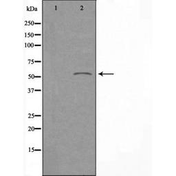 Western blot analysis of K562 cells and HepG2 cells using 2E1 (Cytochrome P450) antibody