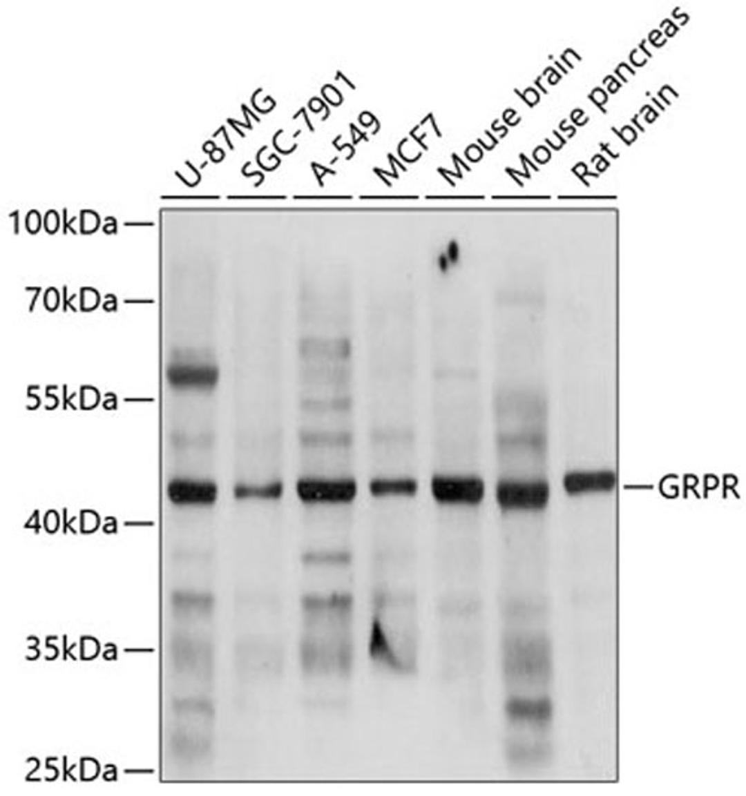 Western blot - GRPR antibody (A2940)