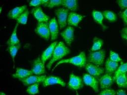 Immunofluorescence staining of MCF-7 cells with Human anti Human CD127 (HCA145)