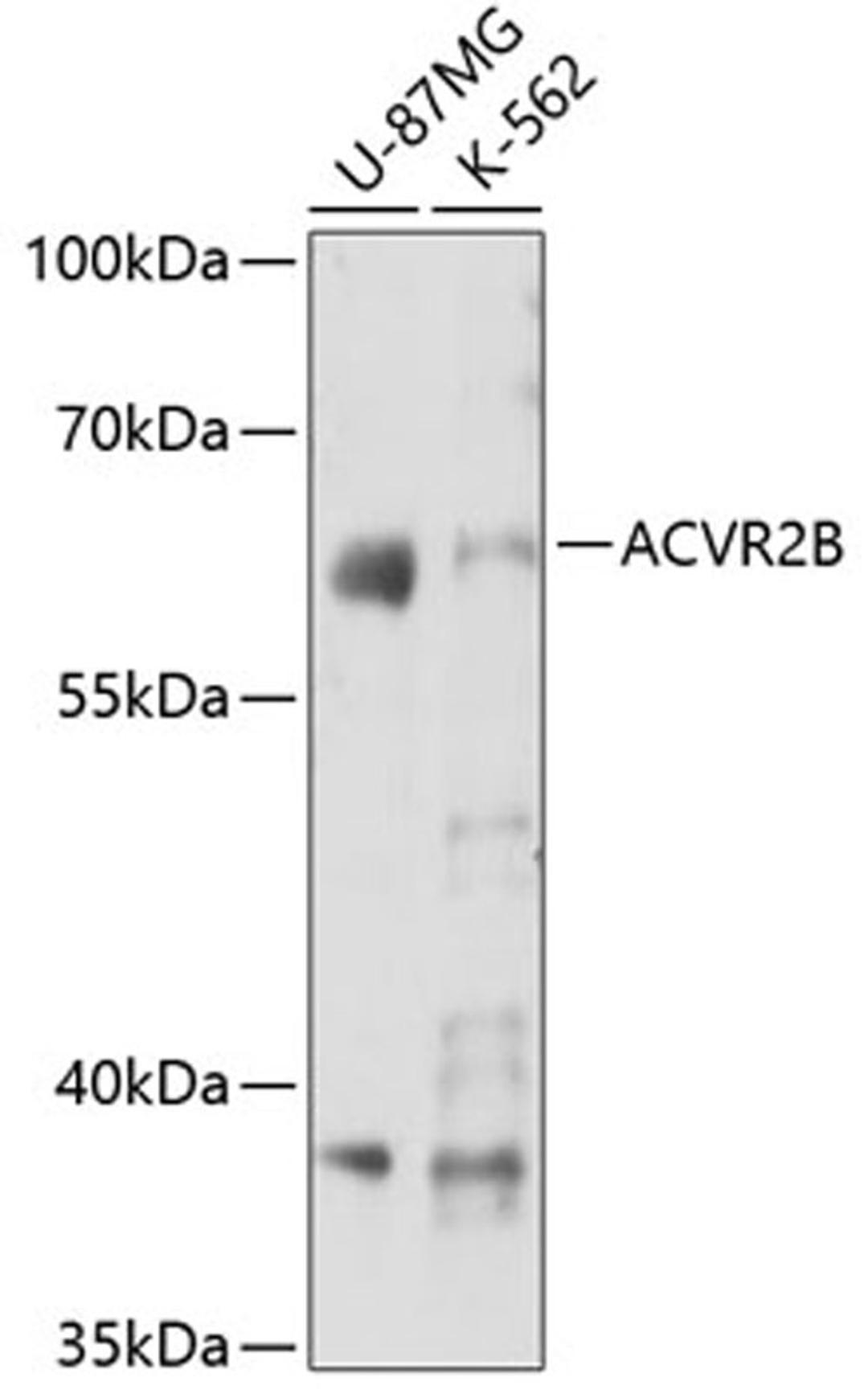 Western blot - ACVR2B antibody (A7868)