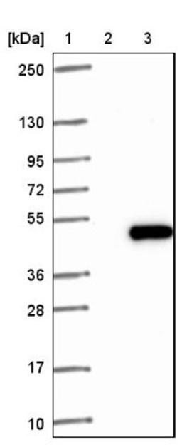 Western Blot: RPP40 Antibody [NBP1-88765] - Lane 1: Marker [kDa] 250, 130, 95, 72, 55, 36, 28, 17, 10<br/>Lane 2: Negative control (vector only transfected HEK293T lysate)<br/>Lane 3: Over-expression lysate (Co-expressed with a C-terminal myc-DDK tag (~3.1 kDa) in mammalian HEK293T cells, LY416512)