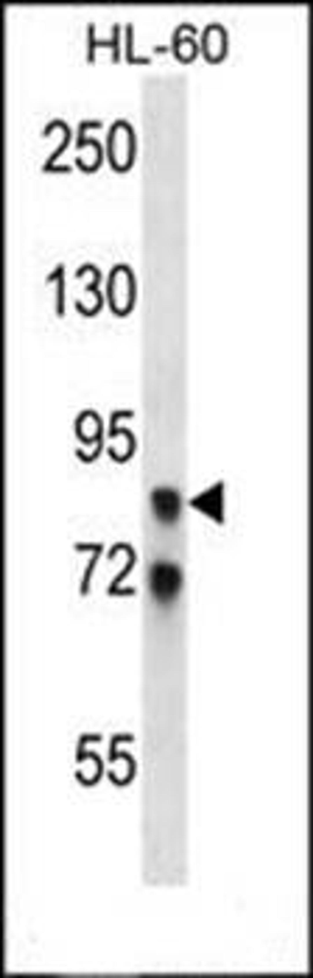 Western blot analysis of HL-60 cell line lysates (35ug/lane) using AKAP4 antibody