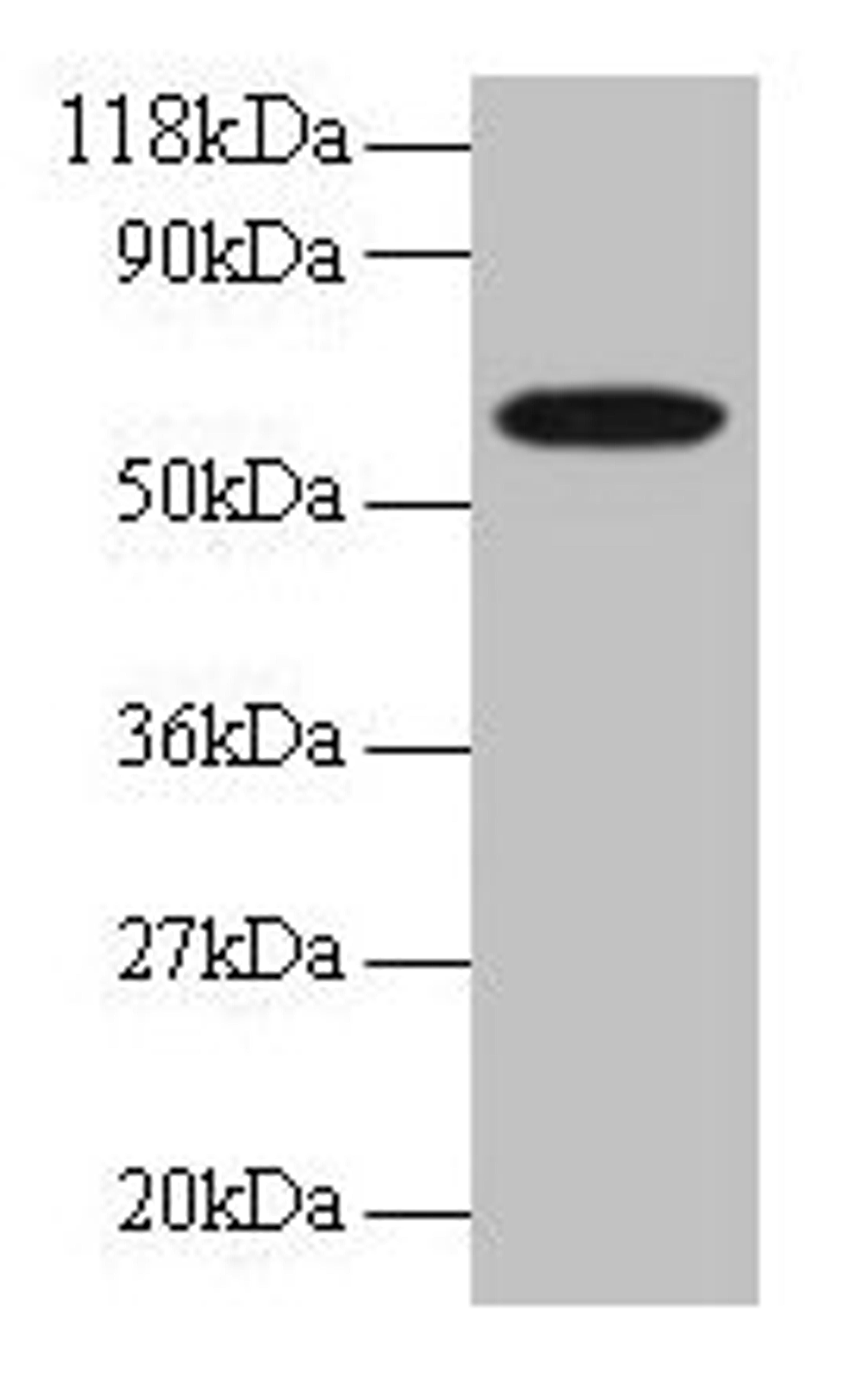 Western blot. All lanes: GABARAPL2 antibody at 2µg/ml + EC109 whole cell lysate. Secondary. Goat polyclonal to rabbit IgG at 1/15000 dilution. Predicted band size: 14 kDa. Observed band size: 60 kDa
