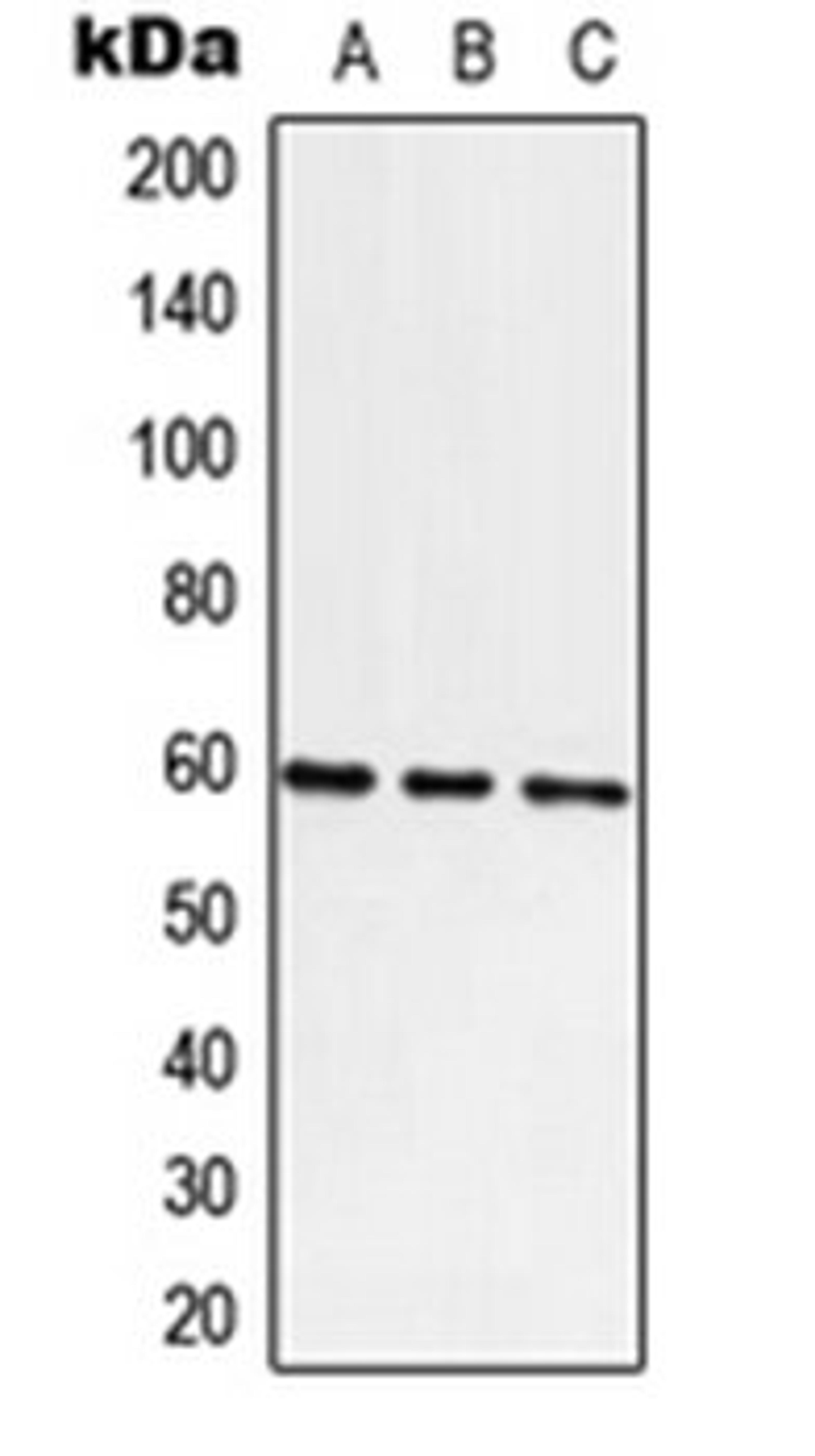 Western blot analysis of A549 (Lane 1), Raw264.7 (Lane 2), H9C2 (Lane 3) whole cell lysates using ATE1 antibody