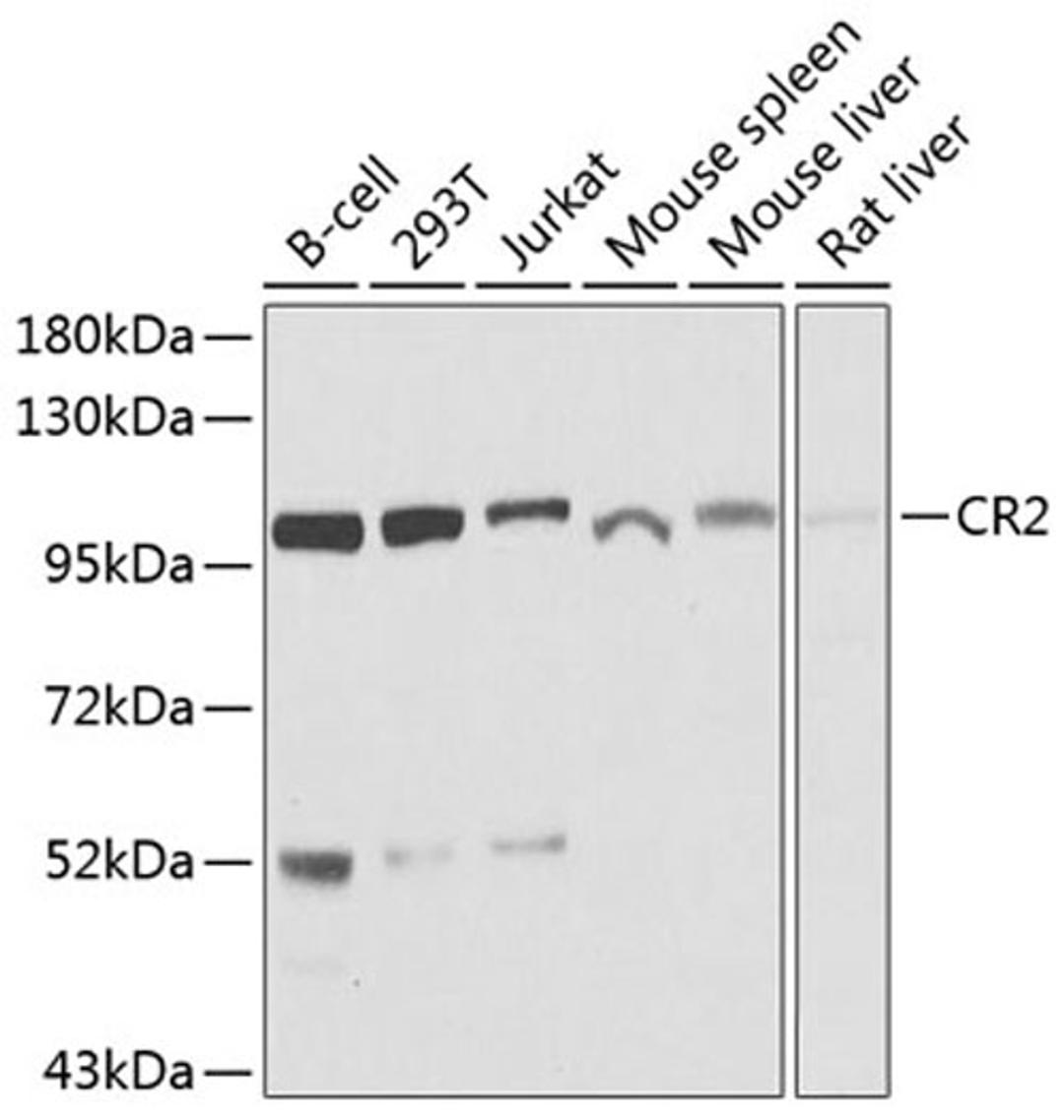 Western blot - CR2 antibody (A8407)