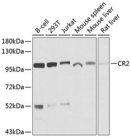 Western blot - CR2 antibody (A8407)