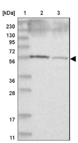 Western Blot: CCDC4 Antibody [NBP1-88163] - Lane 1: Marker [kDa] 230, 130, 95, 72, 56, 36, 28, 17, 11<br/>Lane 2: Human cell line RT-4<br/>Lane 3: Human cell line U-251MG sp