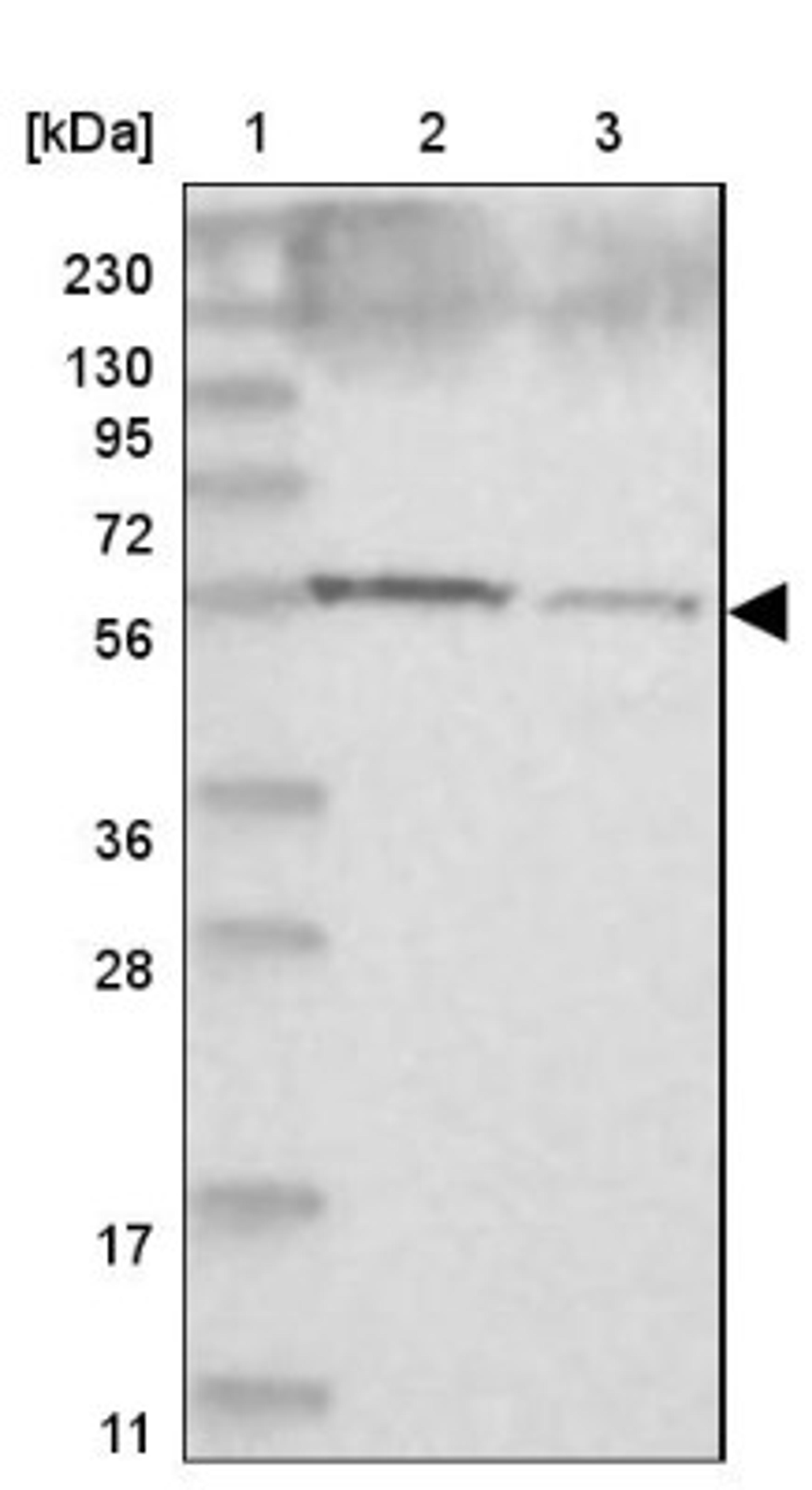 Western Blot: CCDC4 Antibody [NBP1-88163] - Lane 1: Marker [kDa] 230, 130, 95, 72, 56, 36, 28, 17, 11<br/>Lane 2: Human cell line RT-4<br/>Lane 3: Human cell line U-251MG sp