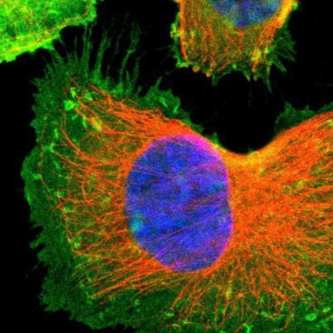 Immunocytochemistry/Immunofluorescence: AKAP12 Antibody [NBP1-89168] - Staining of human cell line U-251MG shows positivity in plasma membrane & cytoplasm.