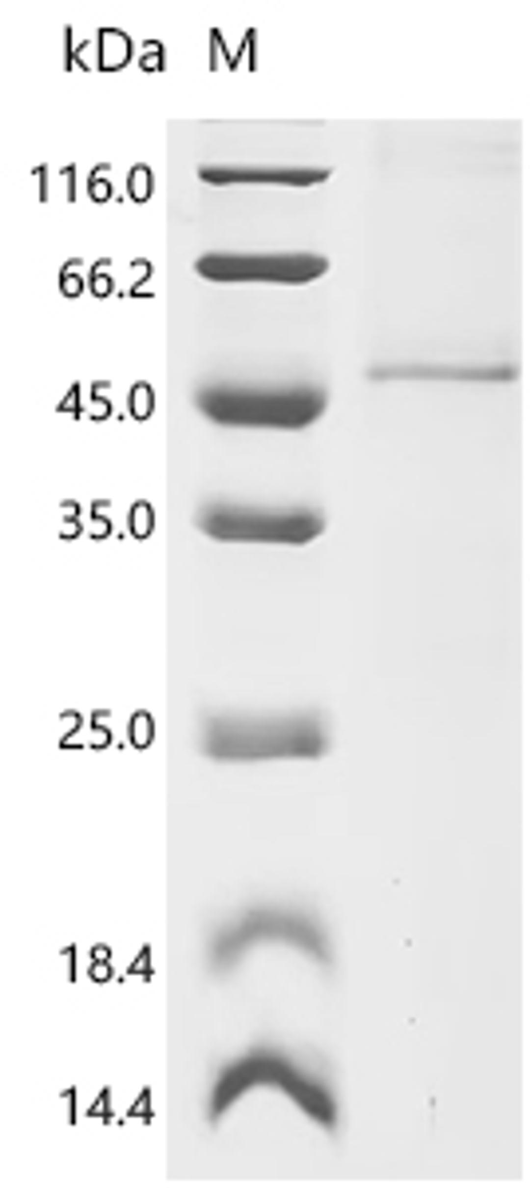 (Tris-Glycine gel) Discontinuous SDS-PAGE (reduced) with 5% enrichment gel and 15% separation gel.