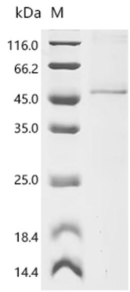 (Tris-Glycine gel) Discontinuous SDS-PAGE (reduced) with 5% enrichment gel and 15% separation gel.