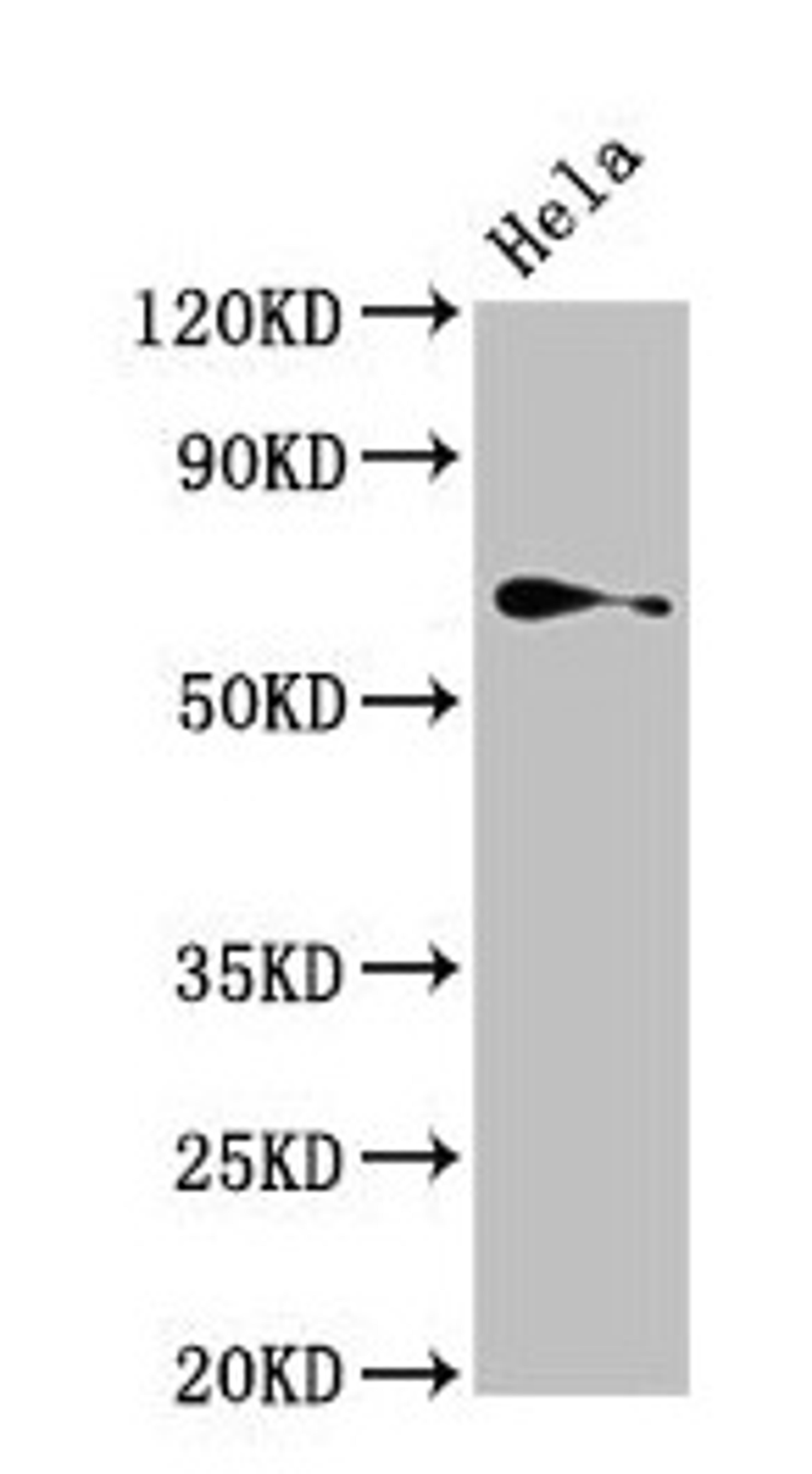 Western Blot. Positive WB detected in: Hela whole cell lysate. All lanes: TRIP4 antibody at 4µg/ml. Secondary. Goat polyclonal to rabbit IgG at 1/50000 dilution. Predicted band size: 67 kDa. Observed band size: 67 kDa