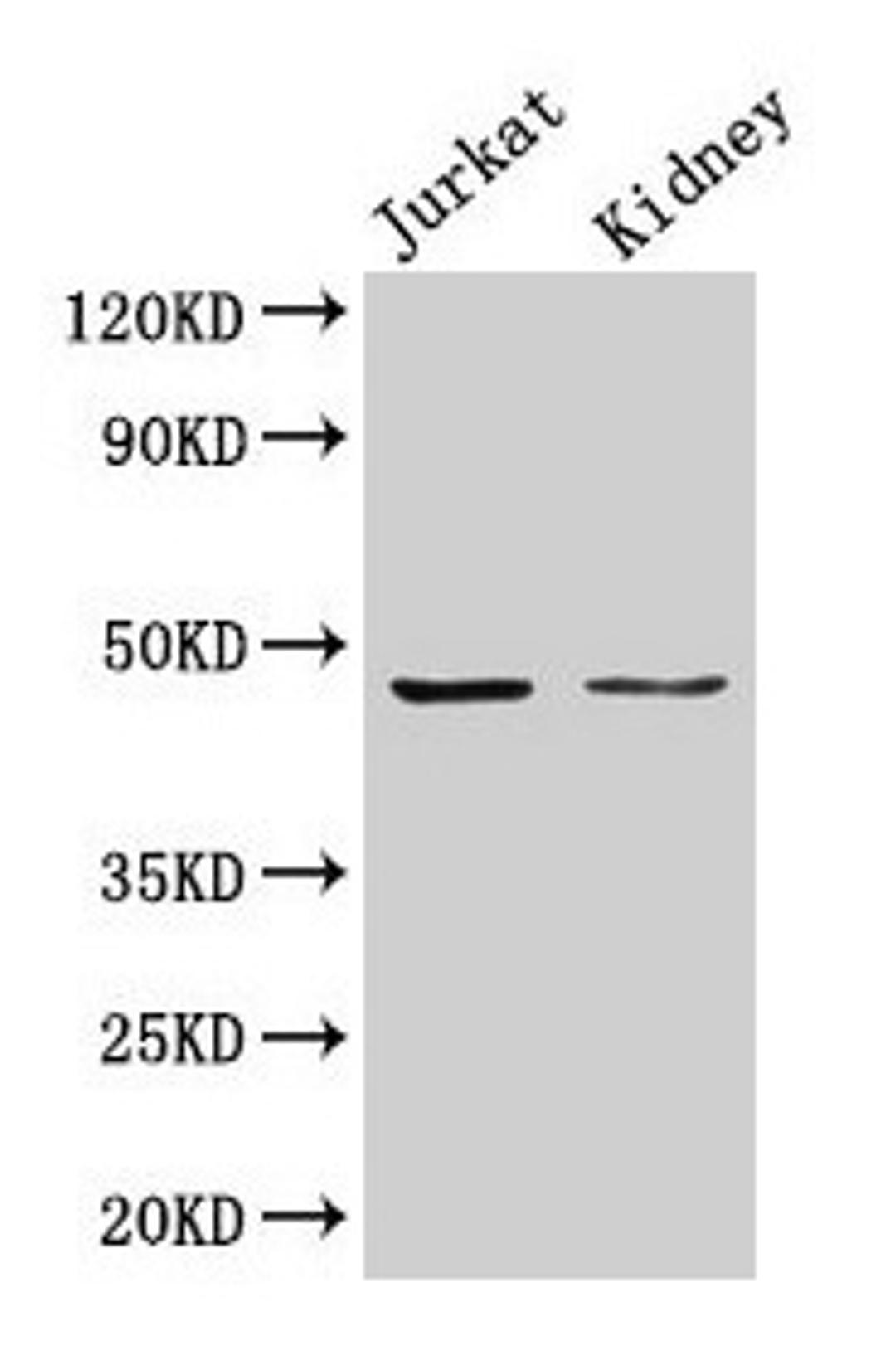 Western Blot. Positive WB detected in: Jurkat whole cell lysate, Rat kidney tissue. All lanes: ALDOA antibody at 3µg/ml. Secondary. Goat polyclonal to rabbit IgG at 1/50000 dilution. Predicted band size: 40, 46 kDa. Observed band size: 46 kDa