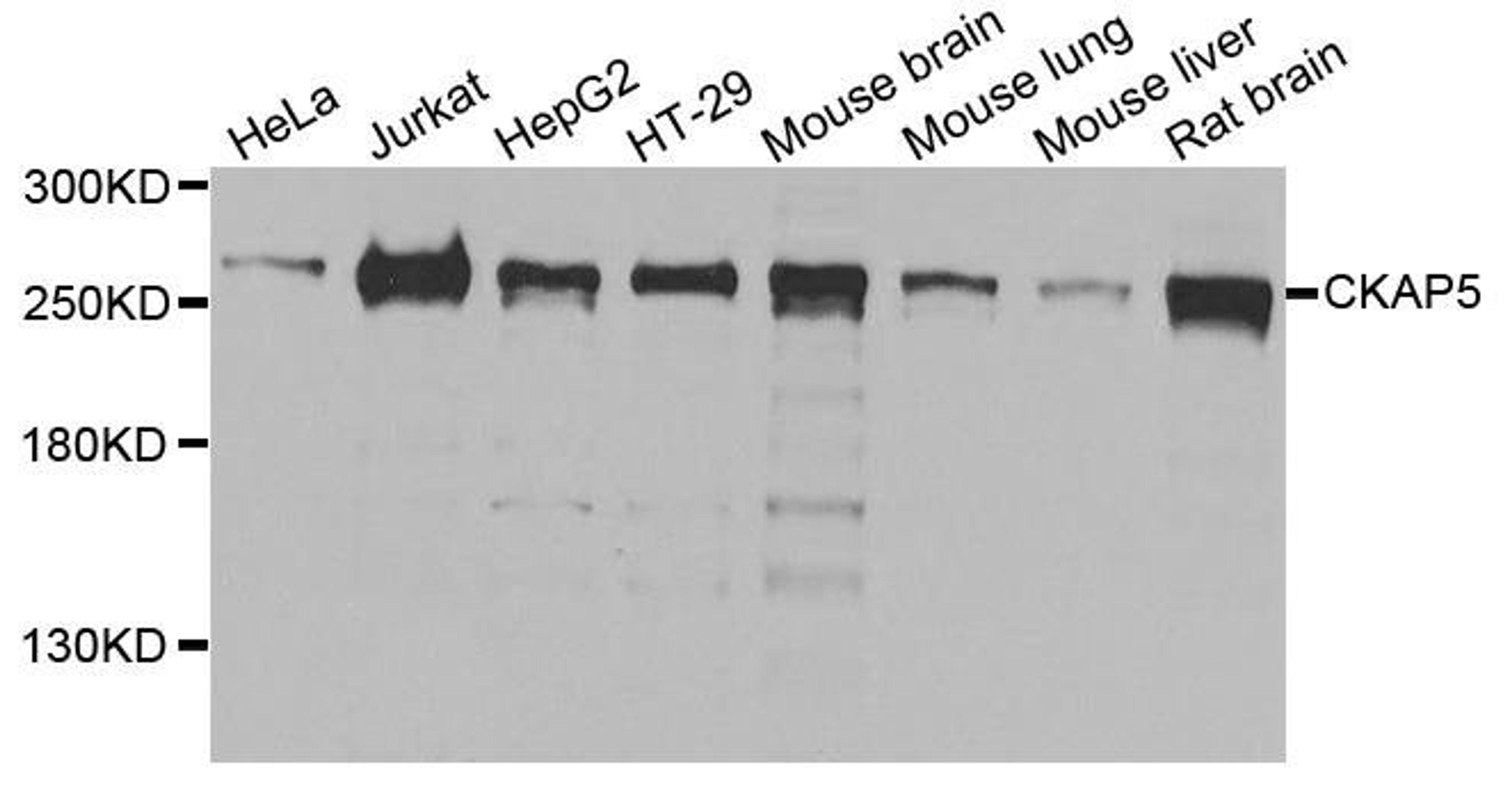 Western blot analysis of extracts of various cells using CKAP5 antibody