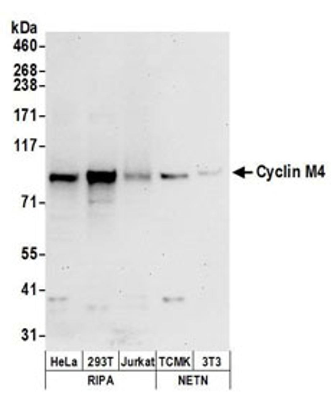 Detection of human and mouse Cyclin M4 by western blot.