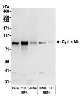 Detection of human and mouse Cyclin M4 by western blot.