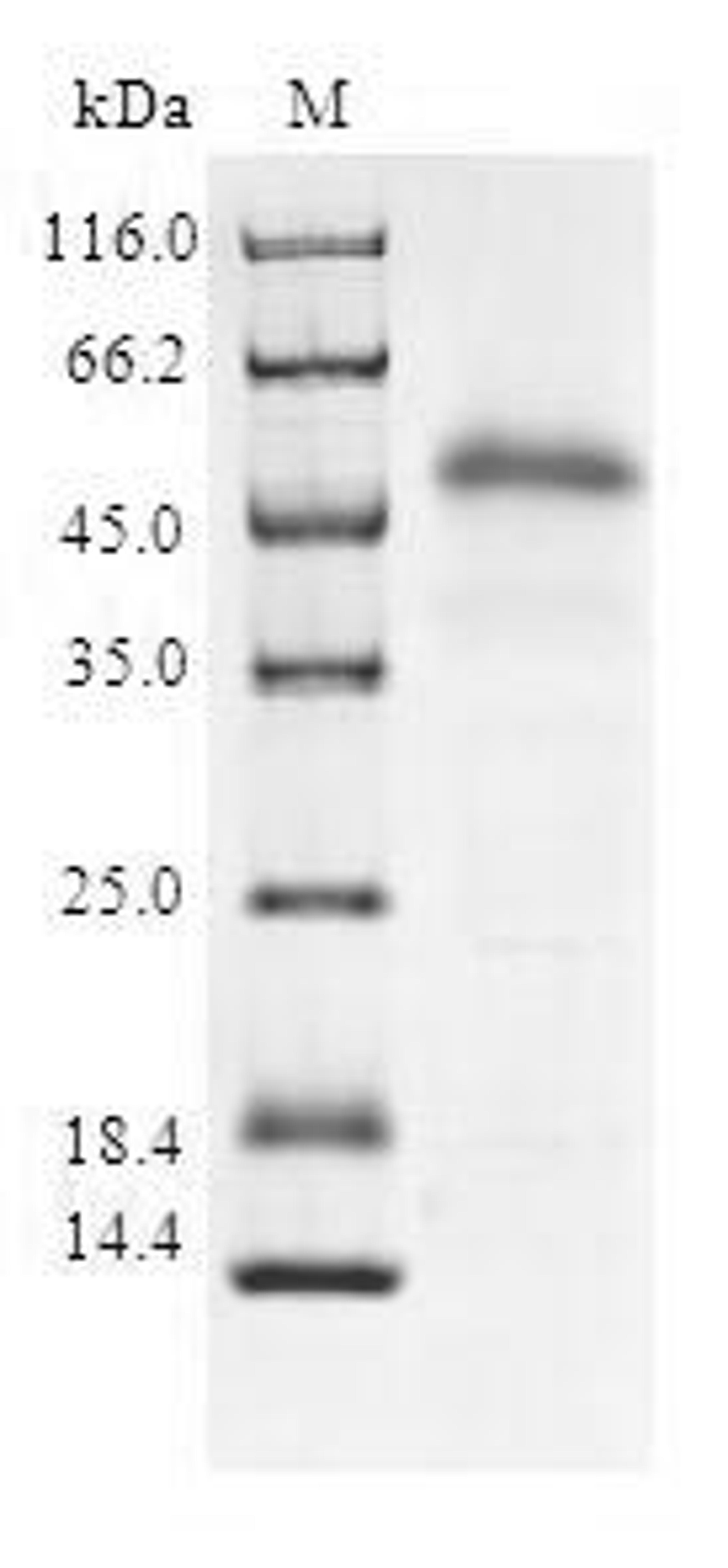 (Tris-Glycine gel) Discontinuous SDS-PAGE (reduced) with 5% enrichment gel and 15% separation gel.