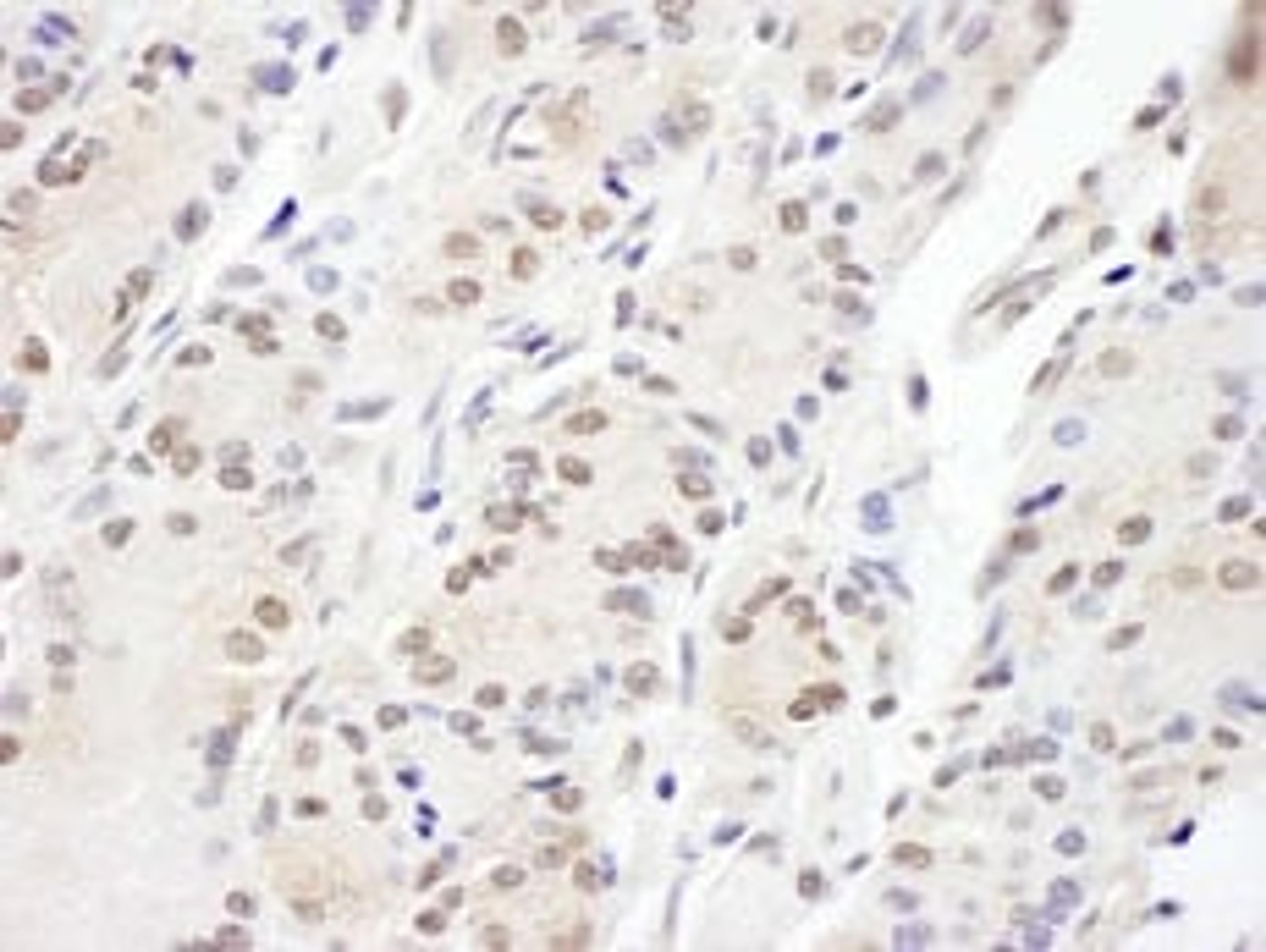 Detection of human Aladin by immunohistochemistry.