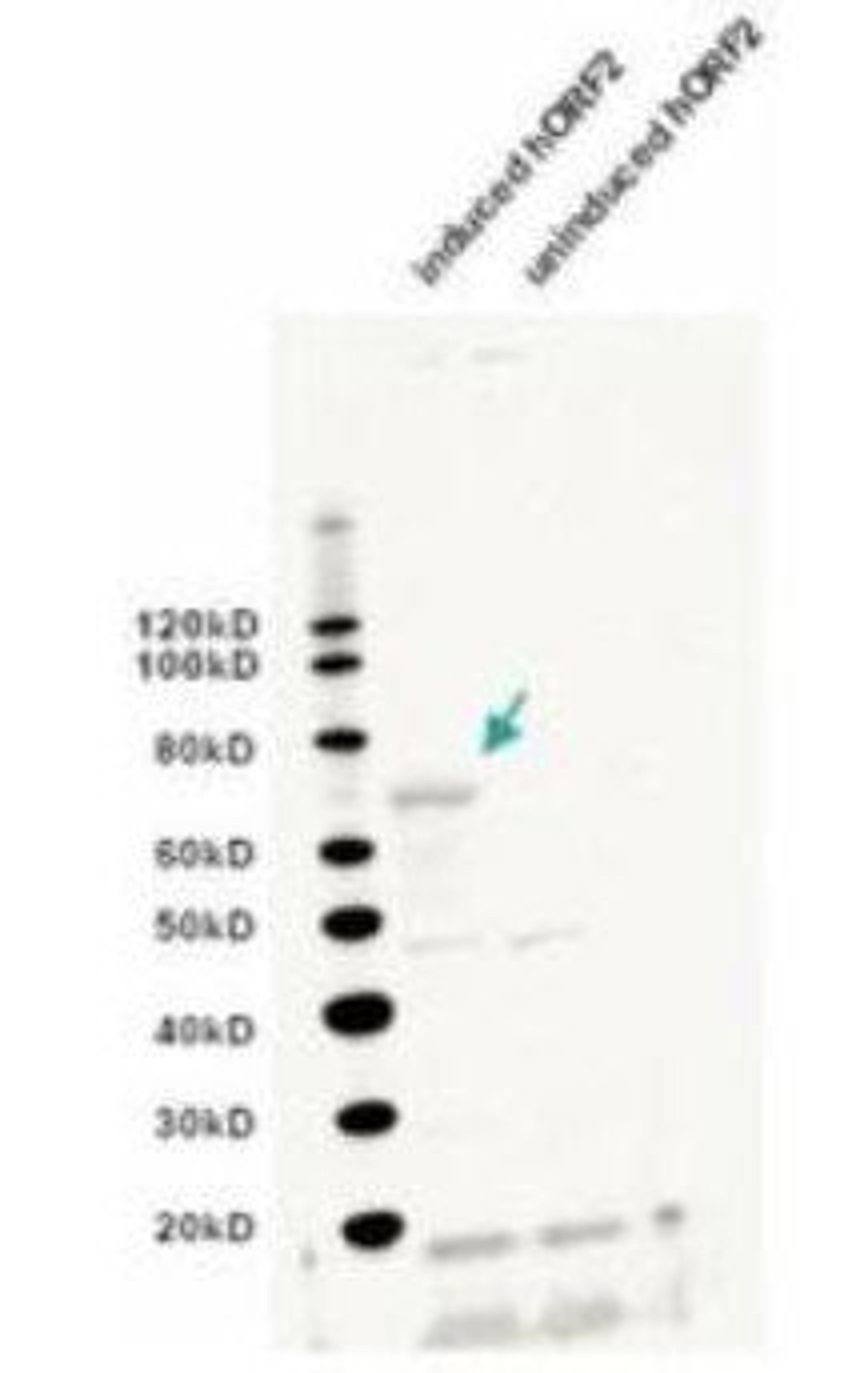 Western blot analysis of expressed human ORF2 (left lane) using L1/ORF2 antibody