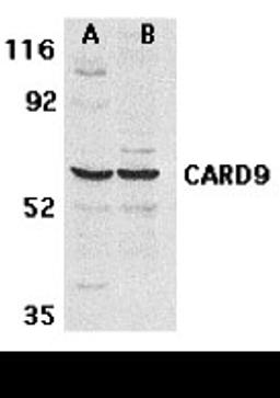 Western blot analysis of CARD9 expression in human MDA-MB-361 (A) and PC-3 (B) cell lysate with CARD9 antibody at 2.5 &#956;g /ml. 