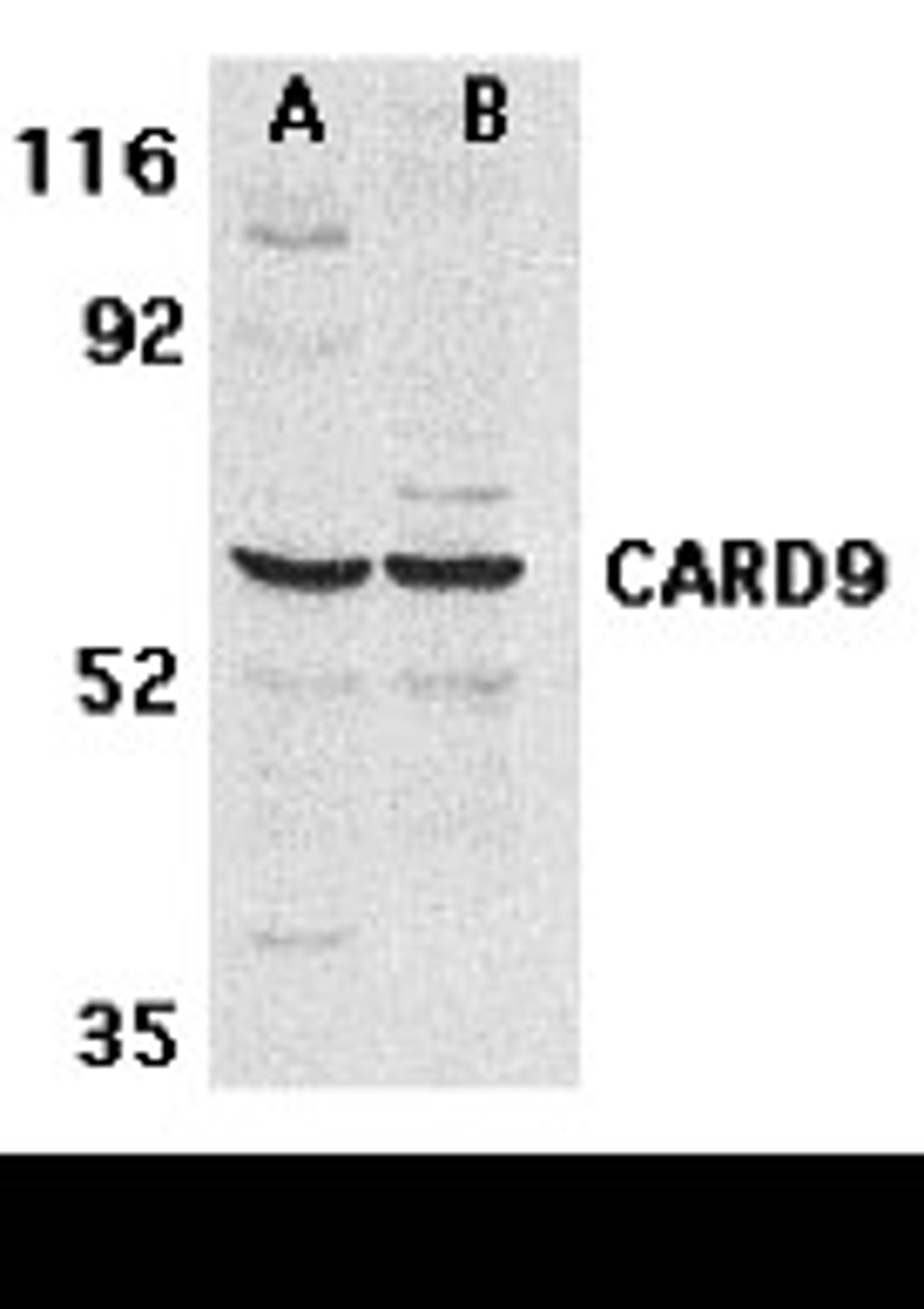 Western blot analysis of CARD9 expression in human MDA-MB-361 (A) and PC-3 (B) cell lysate with CARD9 antibody at 2.5 &#956;g /ml. 