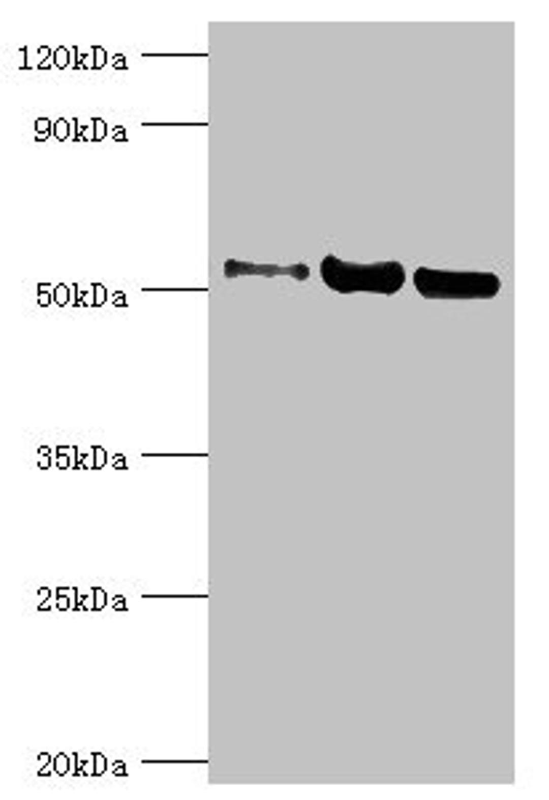 Western blot. All lanes: Carbonic anhydrase 1 antibody at 2ug/ml. Lane 1: HepG2 whole cell lysate. Lane 2: 293T whole cell lysate. Lane 3: 293T whole cell lysate. Secondary. Goat polyclonal to rabbit IgG at 1/10000 dilution. Predicted band size: 53, 14 kDa. Observed band size: 53 kDa. 