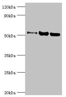 Western blot. All lanes: Carbonic anhydrase 1 antibody at 2ug/ml. Lane 1: HepG2 whole cell lysate. Lane 2: 293T whole cell lysate. Lane 3: 293T whole cell lysate. Secondary. Goat polyclonal to rabbit IgG at 1/10000 dilution. Predicted band size: 53, 14 kDa. Observed band size: 53 kDa. 