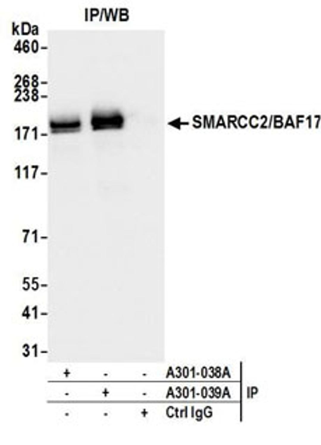 Detection of human SMARCC2/BAF170 by western blot of immunoprecipitates.