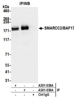 Detection of human SMARCC2/BAF170 by western blot of immunoprecipitates.