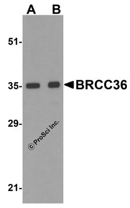 Western blot analysis of BRCC36 in MCF7 cell lysate with BRCC36 antibody at (A) 0.5 and (B) 1 μg/mL.