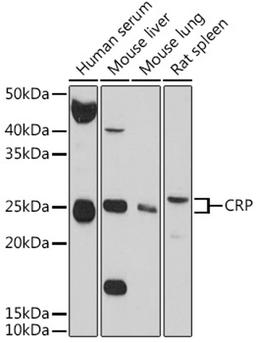 Western blot - CRP antibody (A0224)