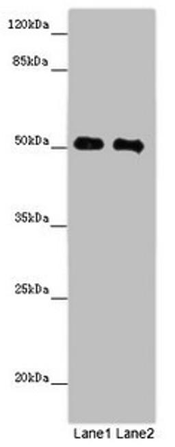 Western blot. All lanes: MCRS1 antibody at 8ug/ml. Lane 1: Jurkat whole cell lysate. Lane 2: Hela whole cell lysate. Secondary. Goat polyclonal to rabbit IgG at 1/10000 dilution. Predicted band size: 52, 54, 51, 32 kDa. Observed band size: 52 kDa. 