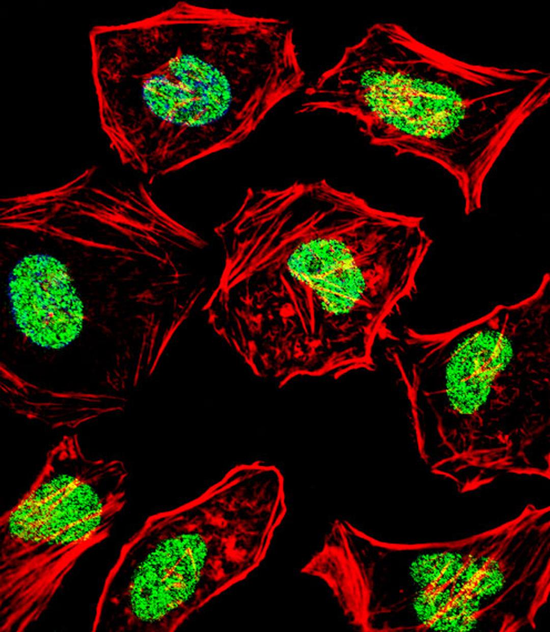 Fluorescent confocal image of Hela cell stained with HAND2 Antibody .Hela cells were fixed with 4% PFA (20 min), permeabilized with Triton X-100 (0.1%, 10 min), then incubated with HAND2 primary antibody (1:25). For secondary antibody, Alexa Fluor 488 con