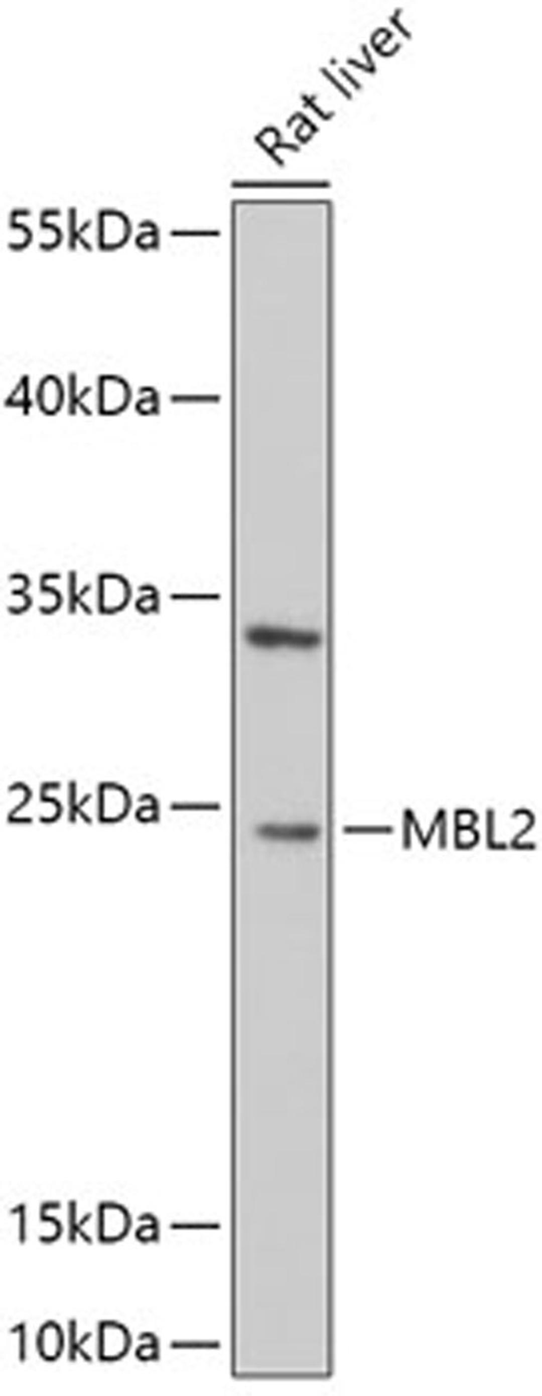 Western blot - MBL2 antibody (A5825)