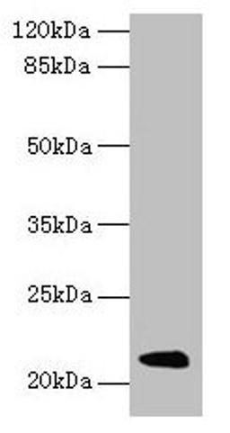 Western blot. All lanes: Mup11 antibody at 2µg/ml + Mouse liver tissue. Secondary. Goat polyclonal to rabbit IgG at 1/10000 dilution. Predicted band size: 21 kDa. Observed band size: 21 kDa