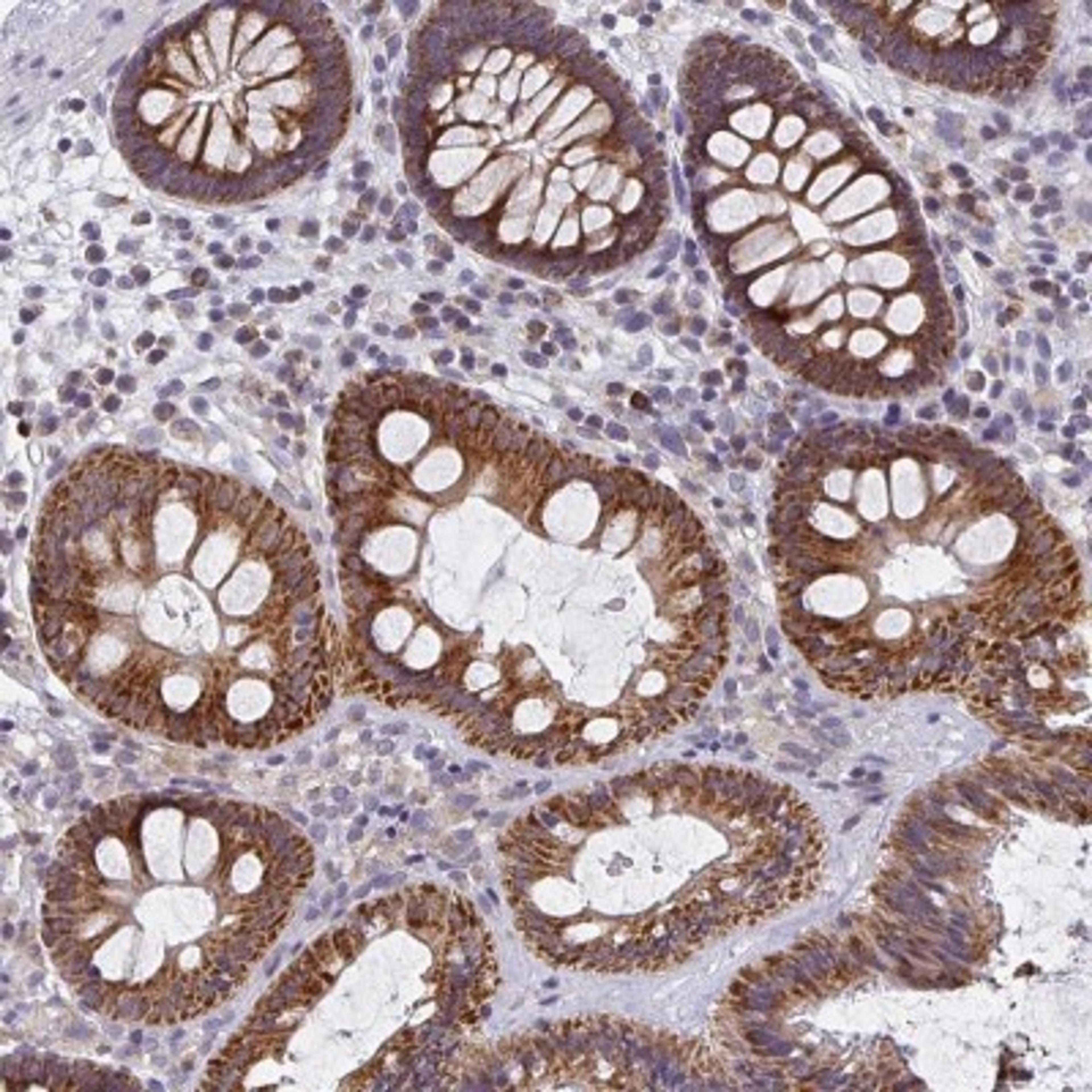 Immunohistochemistry: CTHRC1 Antibody [NBP2-31797] - Staining of human colon shows strong cytoplasmic positivity in glandular cells.