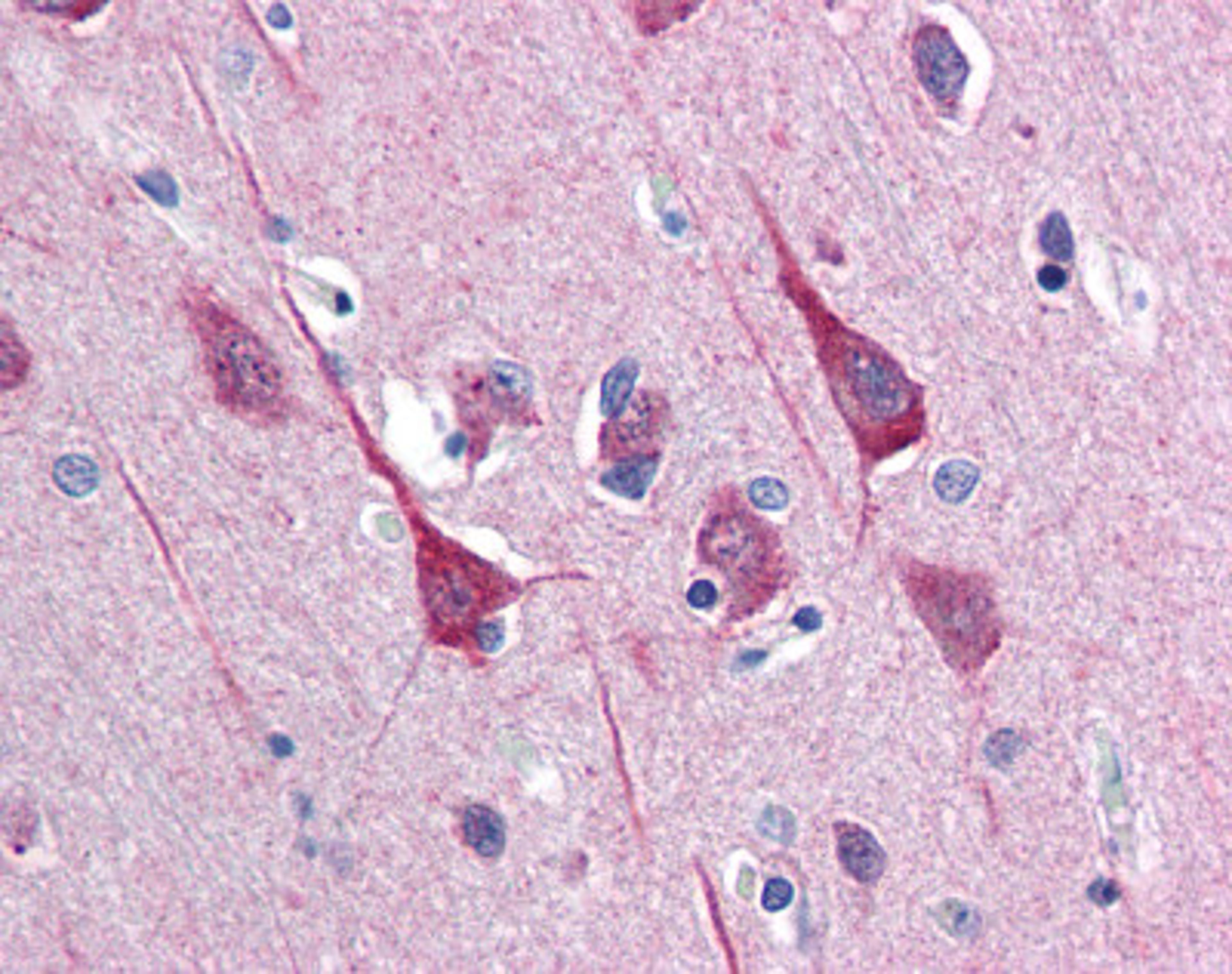 Immunohistochemistry staining of DISC1 in brain cortex tissue using DISC1 Antibody.