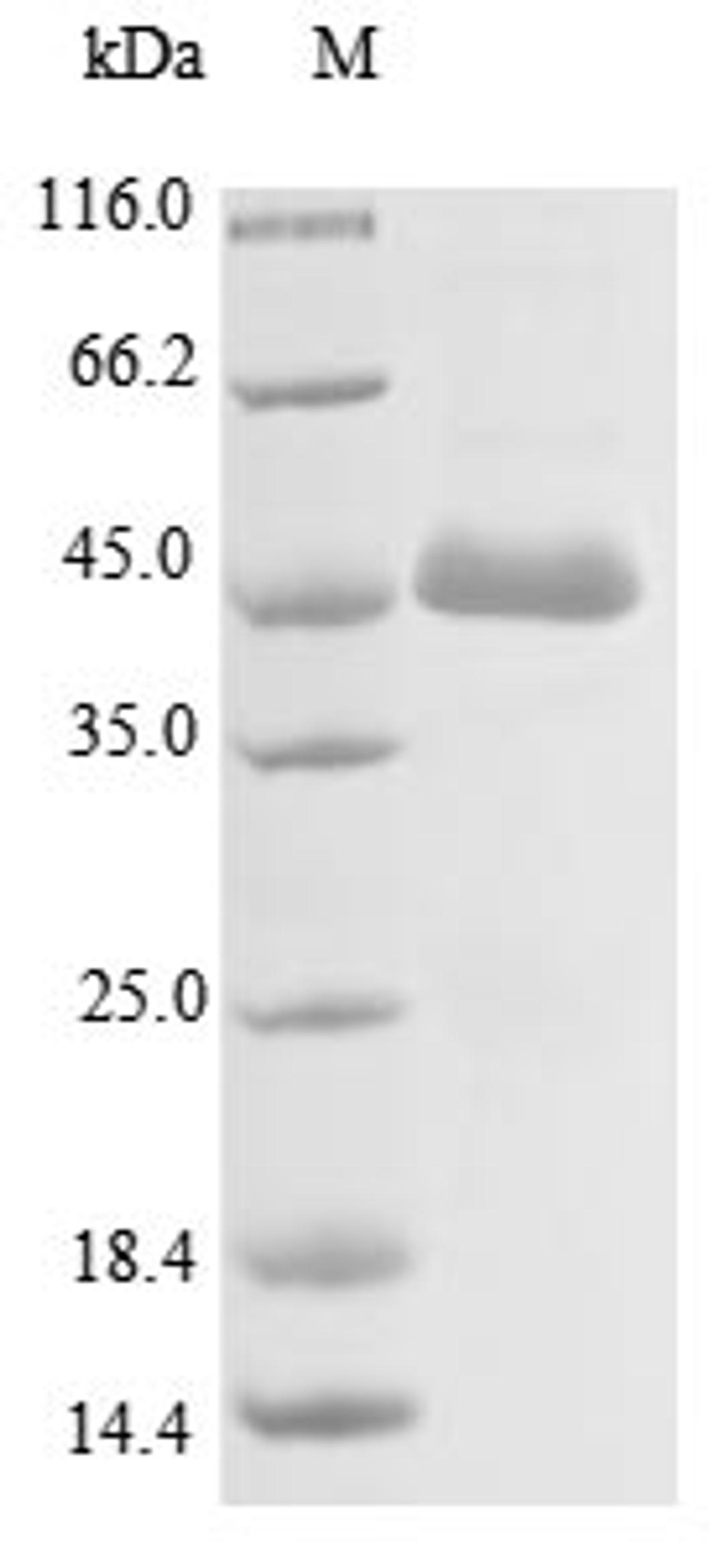 (Tris-Glycine gel) Discontinuous SDS-PAGE (reduced) with 5% enrichment gel and 15% separation gel.