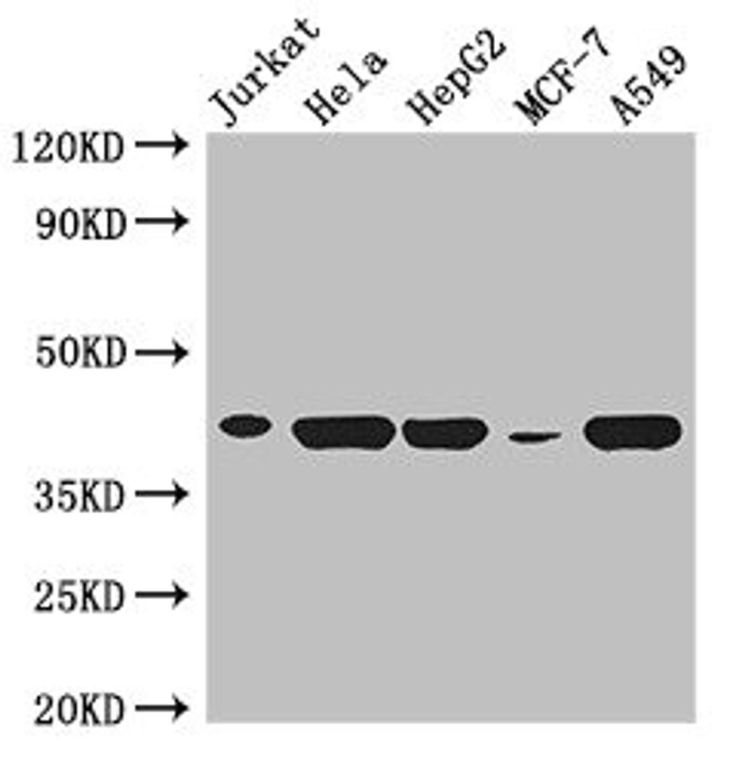 Western Blot. Positive WB detected in: Jurkat whole cell lysate, Hela whole cell lysate, HepG2 whole cell lysate, MCF-7 whole cell lysate, A549 whole cell lysate. All lanes: HLA-B antibody at 3µg/ml. Secondary. Goat polyclonal to rabbit IgG at 1/50000 dilution. Predicted band size: 41 kDa. Observed band size: 41 kDa