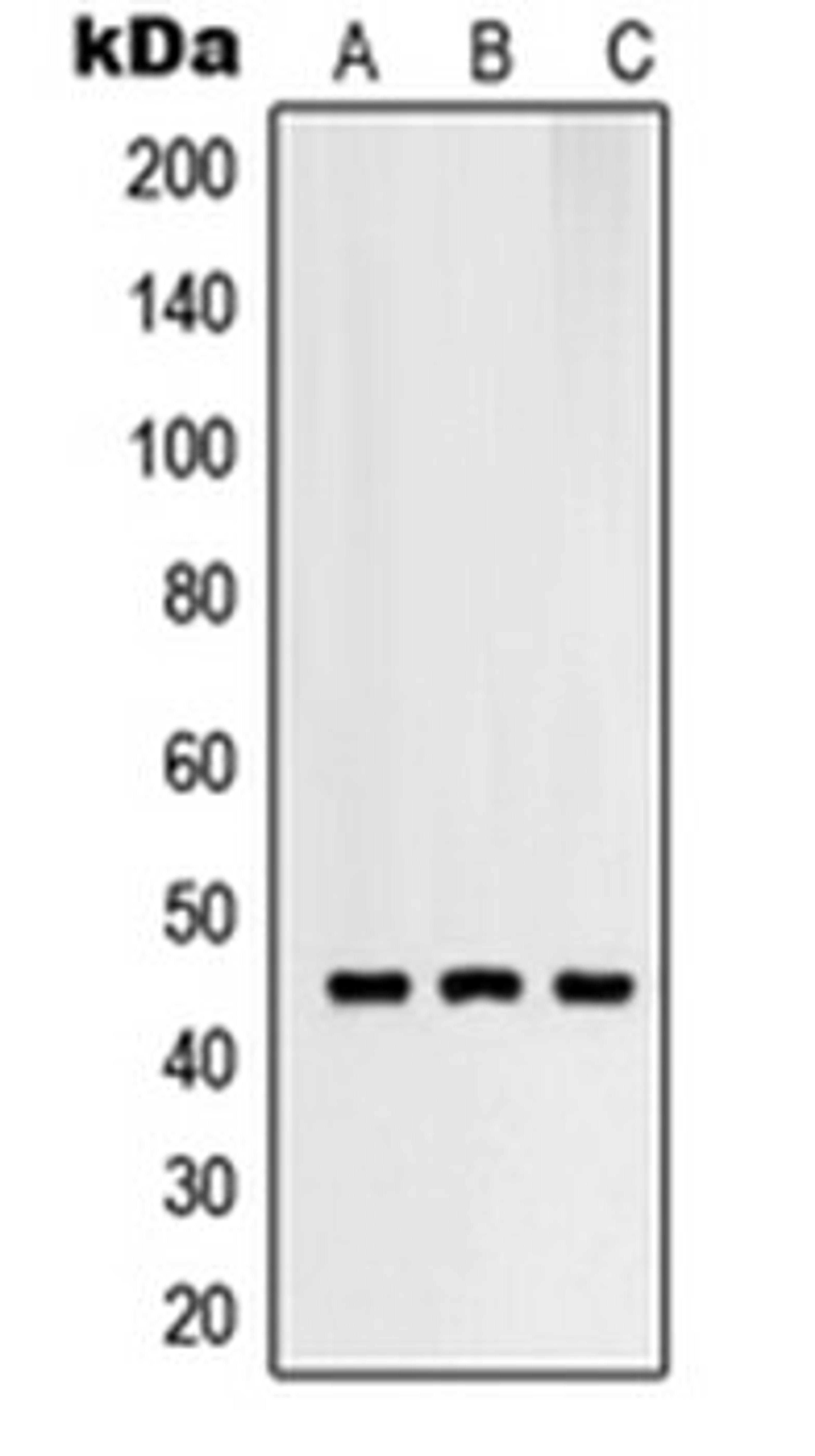 Western blot analysis of SKMEL28 (Lane 1), HuvEc (Lane 2), HeLa (Lane 3) whole cell lysates using RNF130 antibody