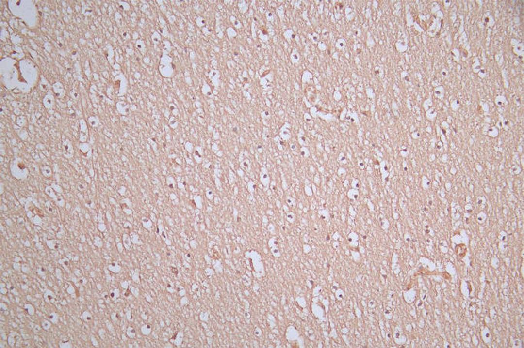 IHC image of CSB-RA021912MA1HU diluted at 1:100 and staining in paraffin-embedded human brain tissue performed on a Leica BondTM system. After dewaxing and hydration, antigen retrieval was mediated by high pressure in a citrate buffer (pH 6.0). Section was blocked with 10% normal goat serum 30min at RT. Then primary antibody (1% BSA) was incubated at 4°C overnight. The primary is detected by a Goat anti-Mouse IgG labeled by HRP and visualized using 0.05% DAB.