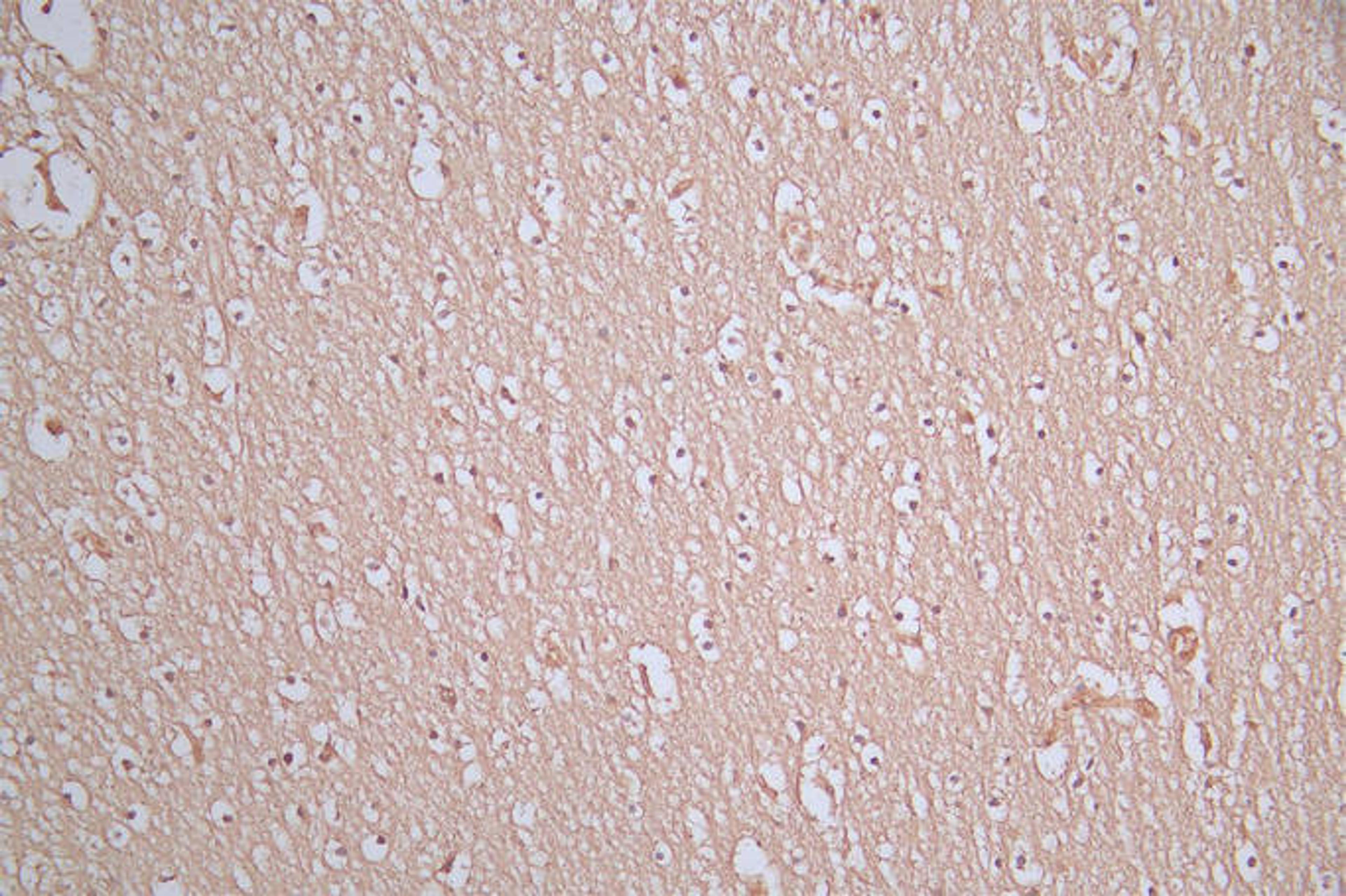 IHC image of CSB-RA021912MA1HU diluted at 1:100 and staining in paraffin-embedded human brain tissue performed on a Leica BondTM system. After dewaxing and hydration, antigen retrieval was mediated by high pressure in a citrate buffer (pH 6.0). Section was blocked with 10% normal goat serum 30min at RT. Then primary antibody (1% BSA) was incubated at 4°C overnight. The primary is detected by a Goat anti-Mouse IgG labeled by HRP and visualized using 0.05% DAB.