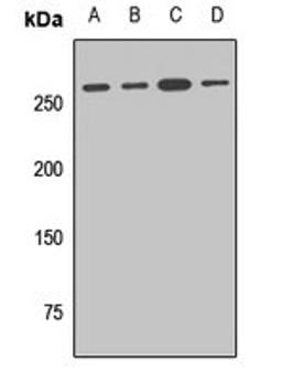 Western blot analysis of Hela (Lane1), A549 (Lane2), mouse heart (Lane3), mouse brain (Lane4) whole cell lysates using GOLGA4 antibody