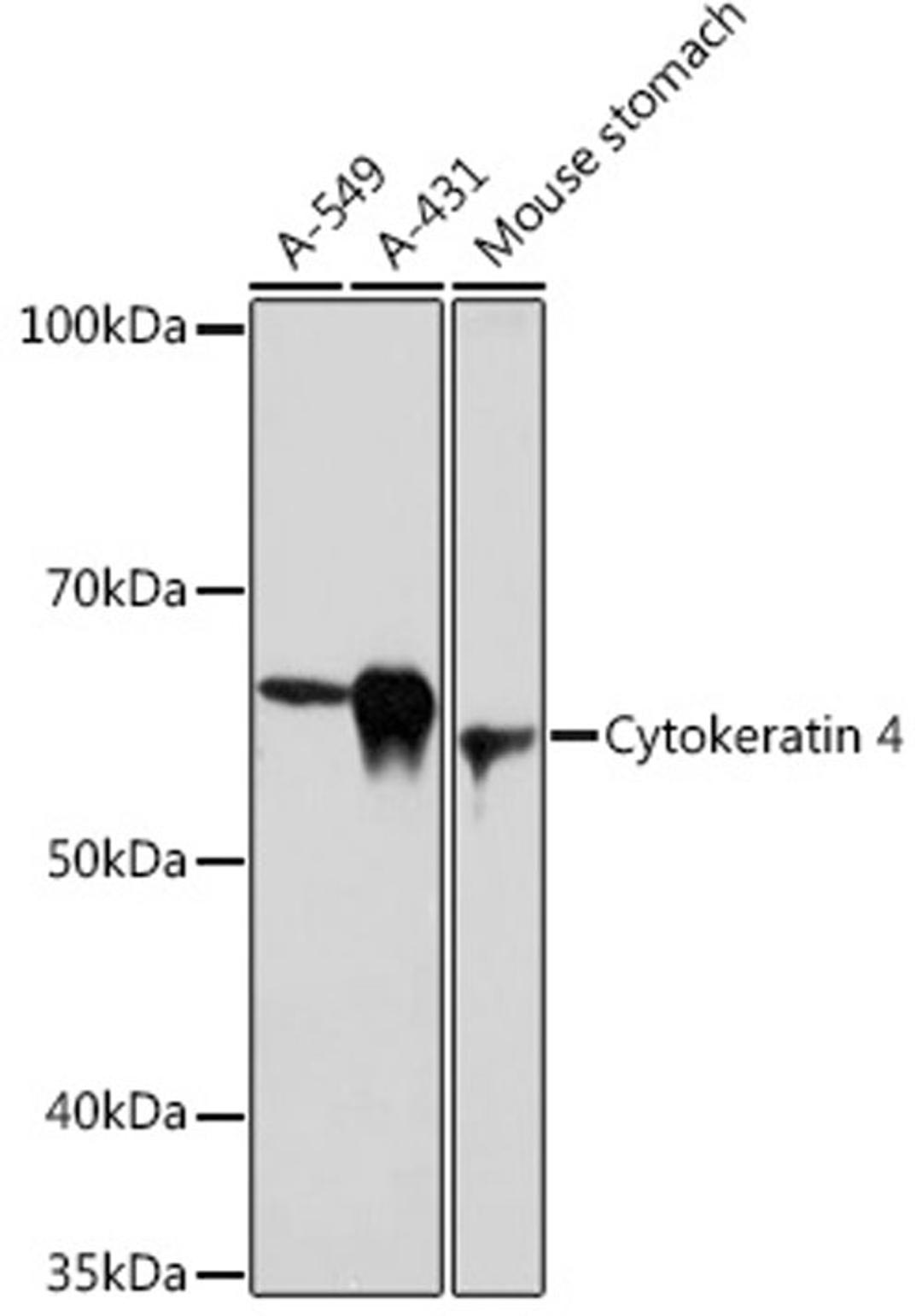 Western blot - Cytokeratin 4 Rabbit mAb (A0013)