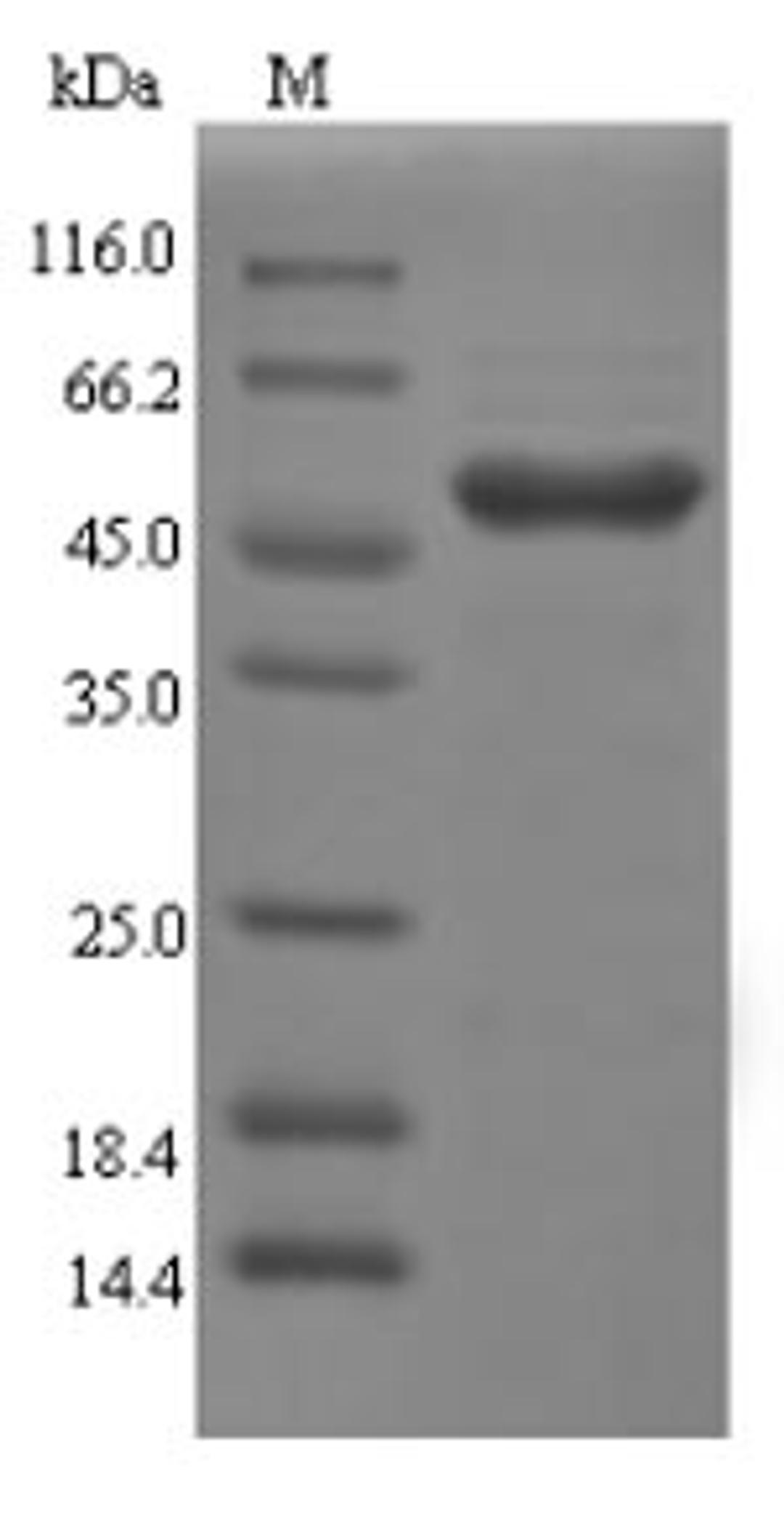 (Tris-Glycine gel) Discontinuous SDS-PAGE (reduced) with 5% enrichment gel and 15% separation gel.
