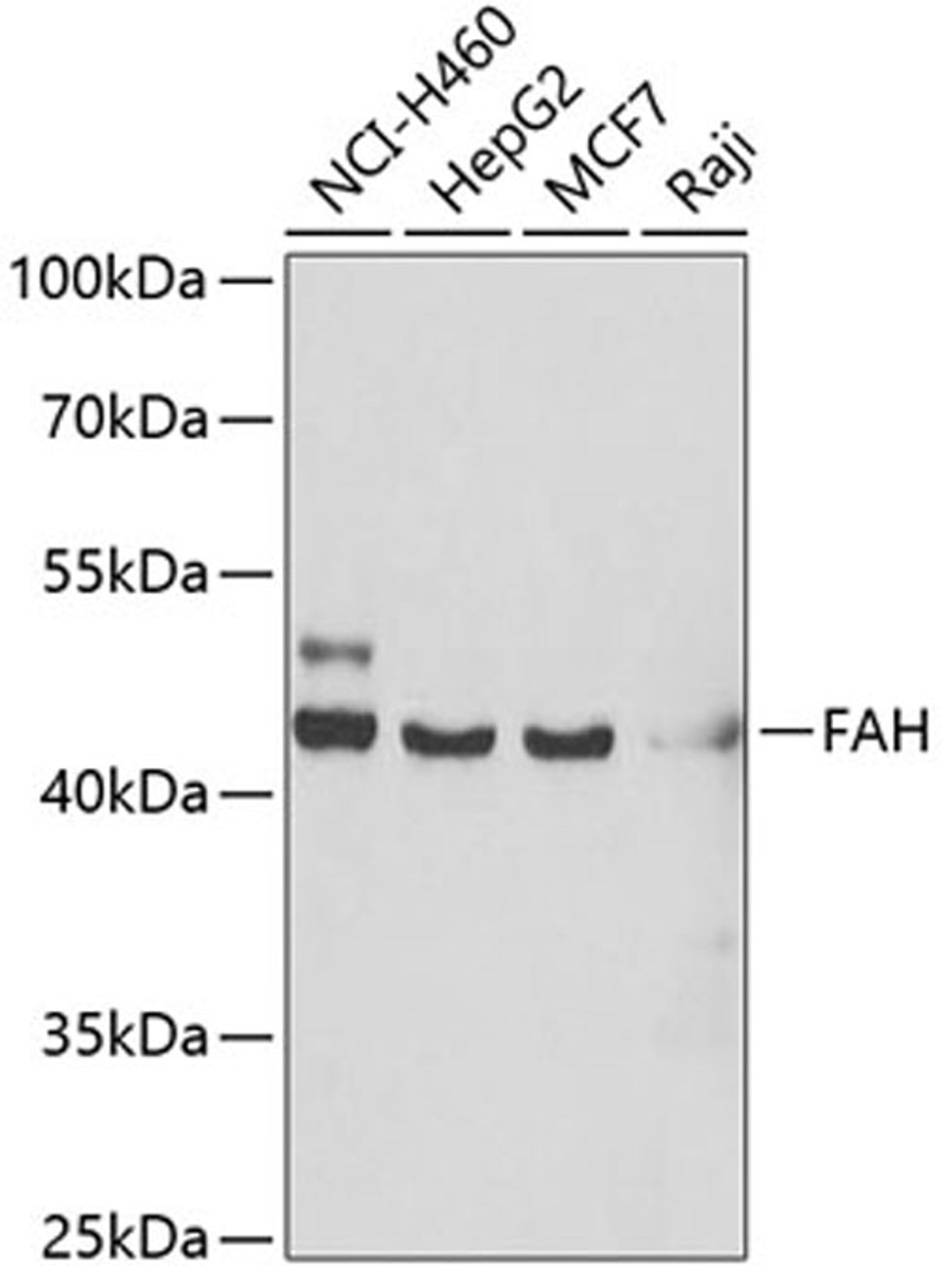 Western blot - FAH antibody (A6586)