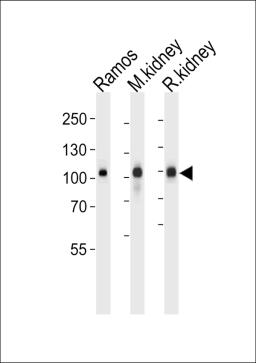 Western blot analysis of lysates from Ramos cell line,mouse kidney and rat kidney tissue (from left to right),using Neprilysin Antibody .AP7329c was diluted at 1:1000 at each lane.