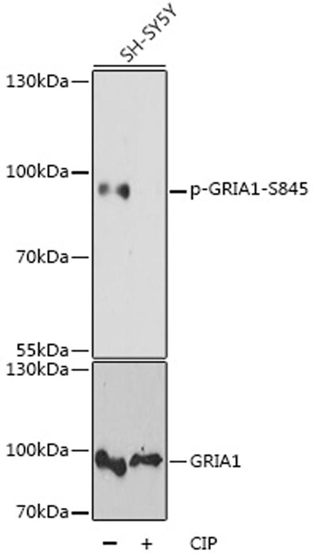 Western blot - Phospho-GRIA1-S845 antibody (AP0825)